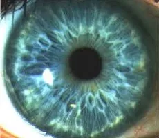 Ce este iris