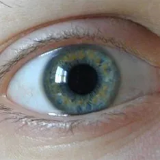 Ce este iris