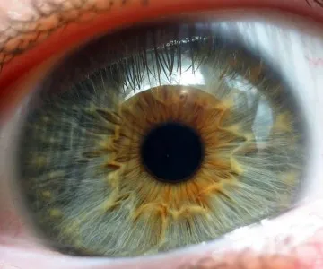 Ce este iris