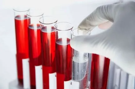 Cum să treacă testele ale glandei tiroide Cum să treacă testele ale glandei tiroide