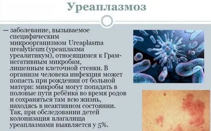 Toate ureaplasmosis tratament Toate ureaplasmosis tratament