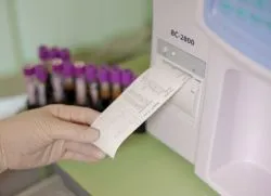 viteza de sedimentare a hematiilor a ceea ce este