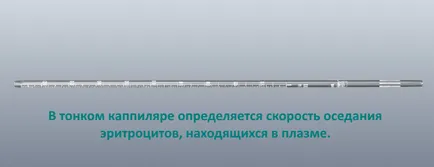 viteza de sedimentare a hematiilor a ceea ce este