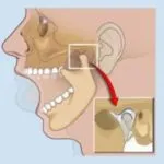 Cum sa scapi de sangerarea gingiilor