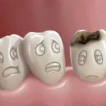 Cum sa scapi de sangerarea gingiilor