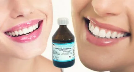 Cum sa scapi de sangerarea gingiilor