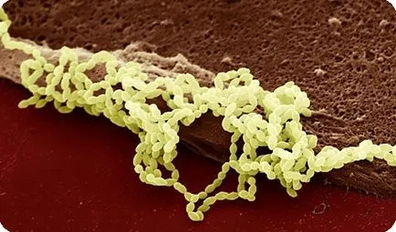 infecție streptococică la copii