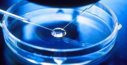 Care este shuvarskogo eșantion