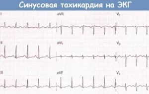 puls rapid că este