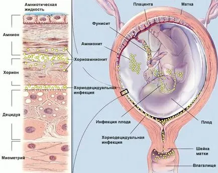 Toate ureaplasmosis tratament