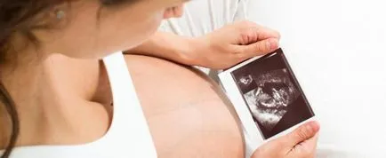 Ultrasunete in al treilea trimestru de sarcină