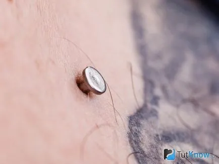 Piercing o selecție transdermic implant site-ul, instruire, îngrijire