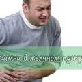 Cum să scapi de bilă Cum să scapi de bilă