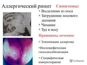 remedii alergice populare de tratament rinita