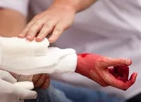 simptome de sângerare arterială și de prim ajutor, cum să se oprească sângerarea