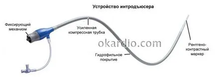 indicații angioplastia de pregătire, modul în care procedura, riscurile (de indicație) indicații angioplastia de pregătire, modul în care procedura, riscurile