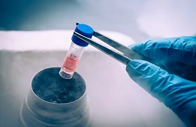 fibroza pulmonara bazala ce este, diagnostic și tratament