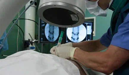Blocada a genunchiului - cauze și soiurile deffektov