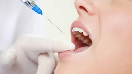 Doare dacă pentru a trage un dinte molar cu procedura de îndepărtare anestezie