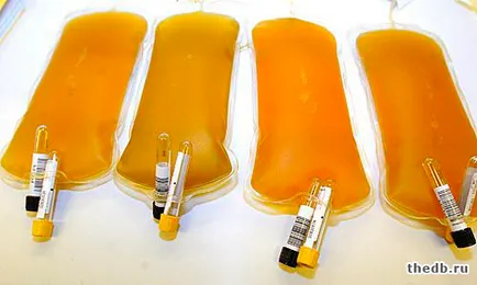 Serul sanguin este diferit de plasma