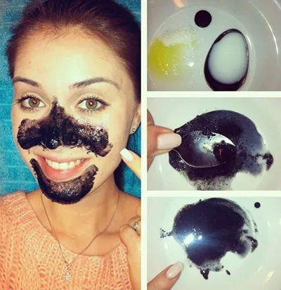 Tratamentul Blackheads și îndepărtarea Comedoanele deschise pe față și nasul unui copil (persoană) Tratamentul Blackheads și îndepărtarea Comedoanele deschise pe față și nasul unui copil