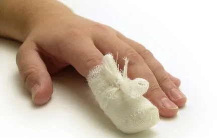 Ce să fac atunci când un prejudiciu de unghii, care va ajuta și că este inutil pentru