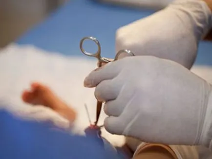 Ce este mutilarea genitală a femeilor și de ce se face cauze, tipuri, imagini și efecte ale circumciziei feminine (a) Ce este mutilarea genitală a femeilor și de ce se face cauze, tipuri, imagini și efecte ale circumciziei feminine
