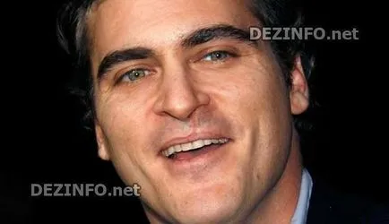 Defecte care desfigurează vedetele de la Hollywood (14 poze) (zile de naștere) Defecte care desfigurează vedetele de la Hollywood (14 poze)