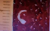 Diphyllobothriasis - cauze, simptome, diagnostic și tratament