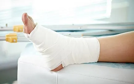 Dimexidum ca soluție diluată manual compresa (soluție) Dimexidum ca soluție diluată manual compresă