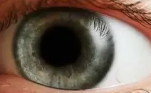 Ecstasy (MDMA) aceasta, simptome de supradozaj, prim ajutor
