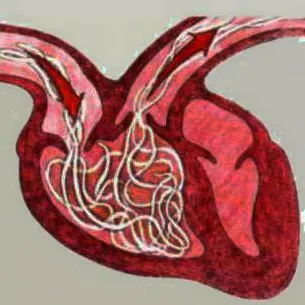 ECG (cardiography) ce este și caracteristici de diagnosticare