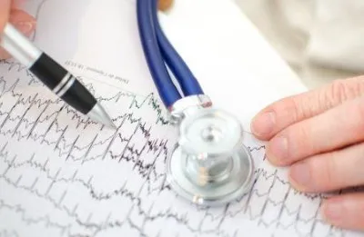 ECG (cardiography) ce este și caracteristici de diagnosticare