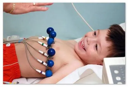 ECG la copii