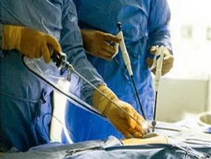 Hernioplasty (herniei) - ceea ce este, chirurgie, preturi, video