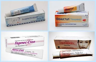 Herpes in timpul sarcinii este periculoasă decât efectul și consecințele (periculoase) Herpes in timpul sarcinii este periculoasă decât efectul și consecințele