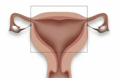 cauze cervicale hipertrofia și tratament ca remedii populare (tratament) aruncare Cauzele hipertrofia cervicale și tratament, cum să scape de remedii populare