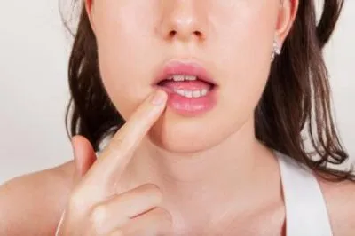 Tratamentul herpesului corporală la remedii acasă populare (condiții) Tratamentul herpesului corporală la căi de atac acasă populare