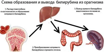 Hiperbilirubinemie cauze neonatale benigne, tratamentul (care apare hiperbilirubinemie) hiperbilirubinemie benign, cauze neonatale, tratament
