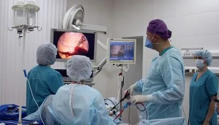 Histeroscopia uterului care se desfășoară și modul în care