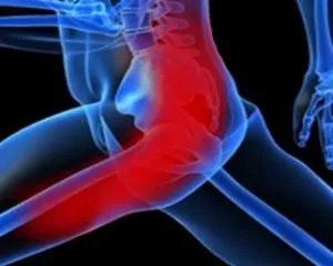 simptome sciatica, cauze, tratament, prevenire