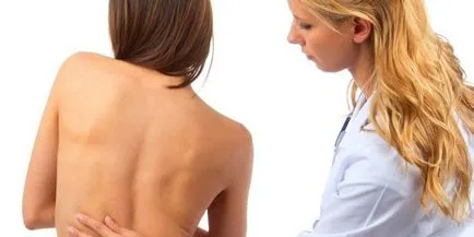 Curbura a caracteristicilor de deformare a coloanei vertebrale și a simptomelor, cum să îndreptați postura dumneavoastră și pentru a preveni