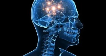accident vascular cerebral creier