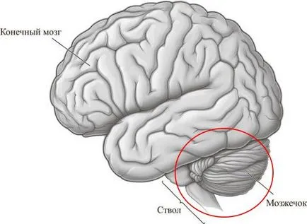 accident vascular cerebral creier