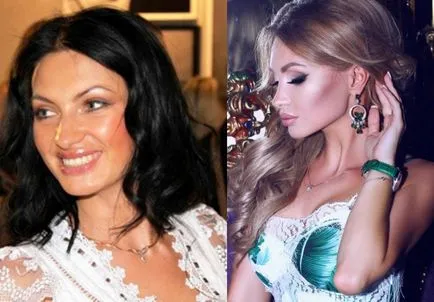 După cum a variat Evgeny Gusev (Feofilaktova) înainte și după rinoplastie și mamoplastie - 300 (Gusev a crescut buzele) După cum a variat Evgeny Gusev (Feofilaktova) înainte și după rinoplastie și mamoplastie - 300