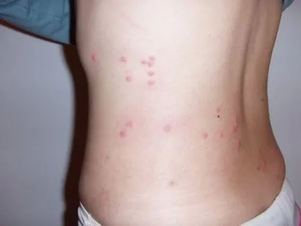 La fel ca musca purici și cum să se ocupe cu ei cele mai bune practici