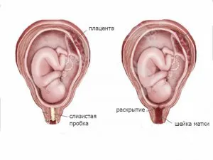 Cum de a determina contracțiile reale inainte de nastere (defini) Cum de a determina contracțiile reale inainte de nastere