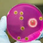 Cum tratamentul Staphylococcus aureus