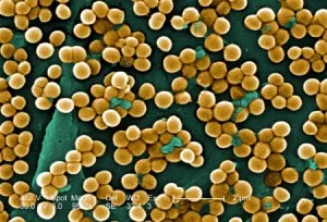 Cum este Staphylococcus aureus infecție 4 varianta