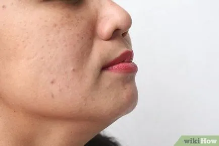 Cum de a preveni de stabilire a urechilor